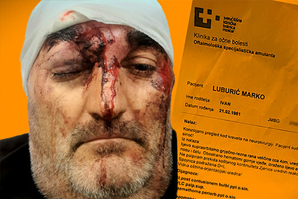 citlucanin tuča